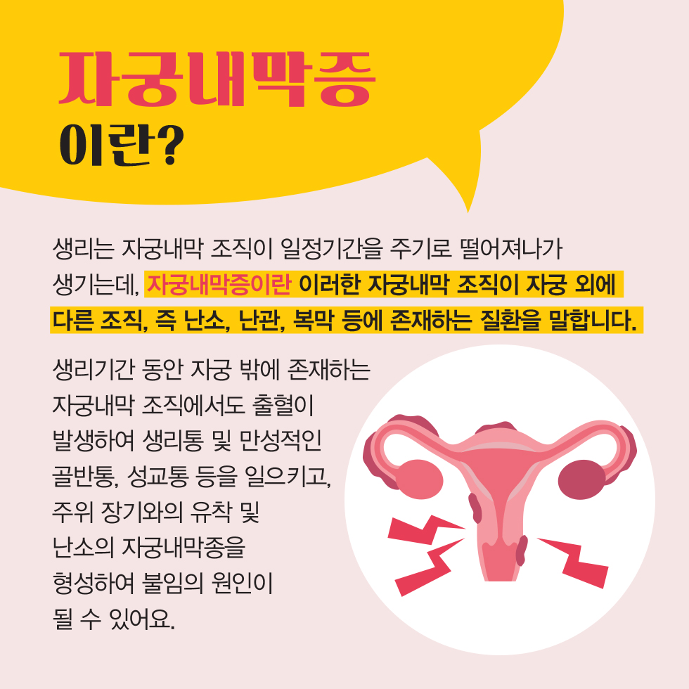자궁내막증.png